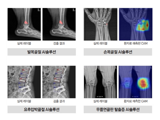 NIPA가 전시하는 의료AI 솔루션